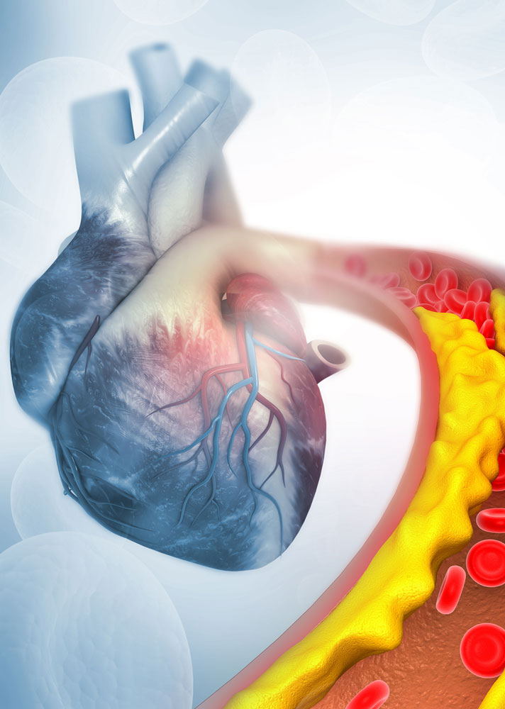 "Gutes" Cholesterin vs "schlechtes" Cholesterin